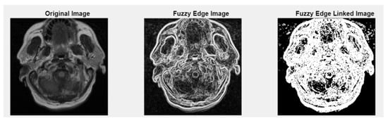 Medsci 13 00097 g005