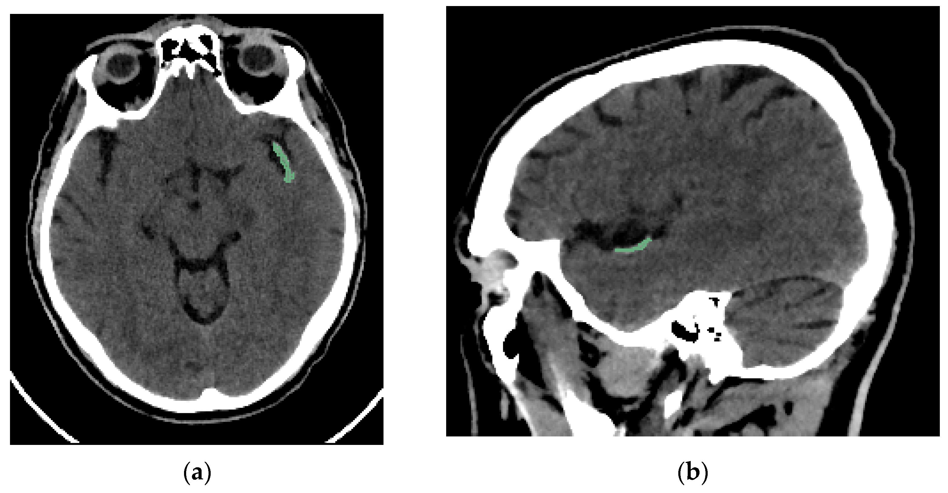 Medsci 13 00098 g002