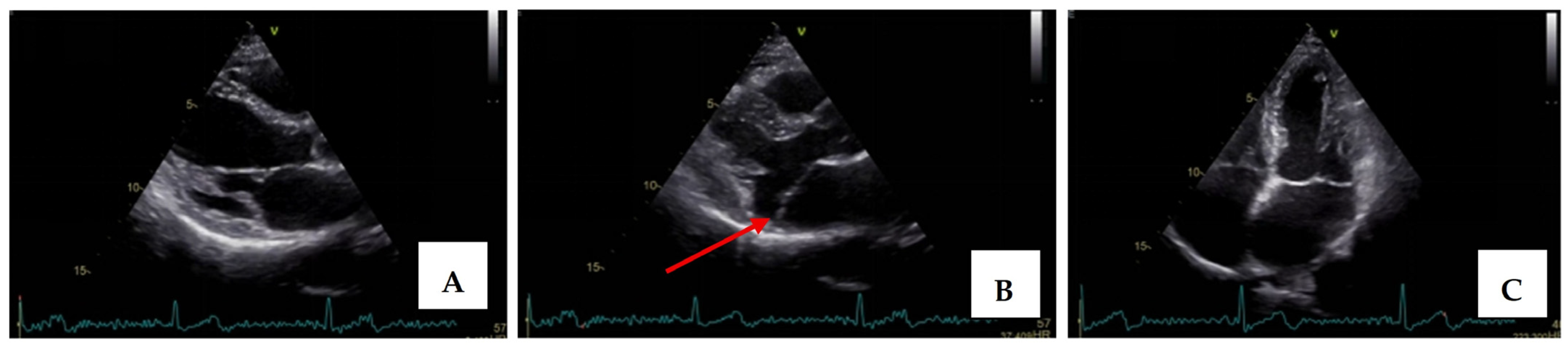 Medsci 13 00185 g002
