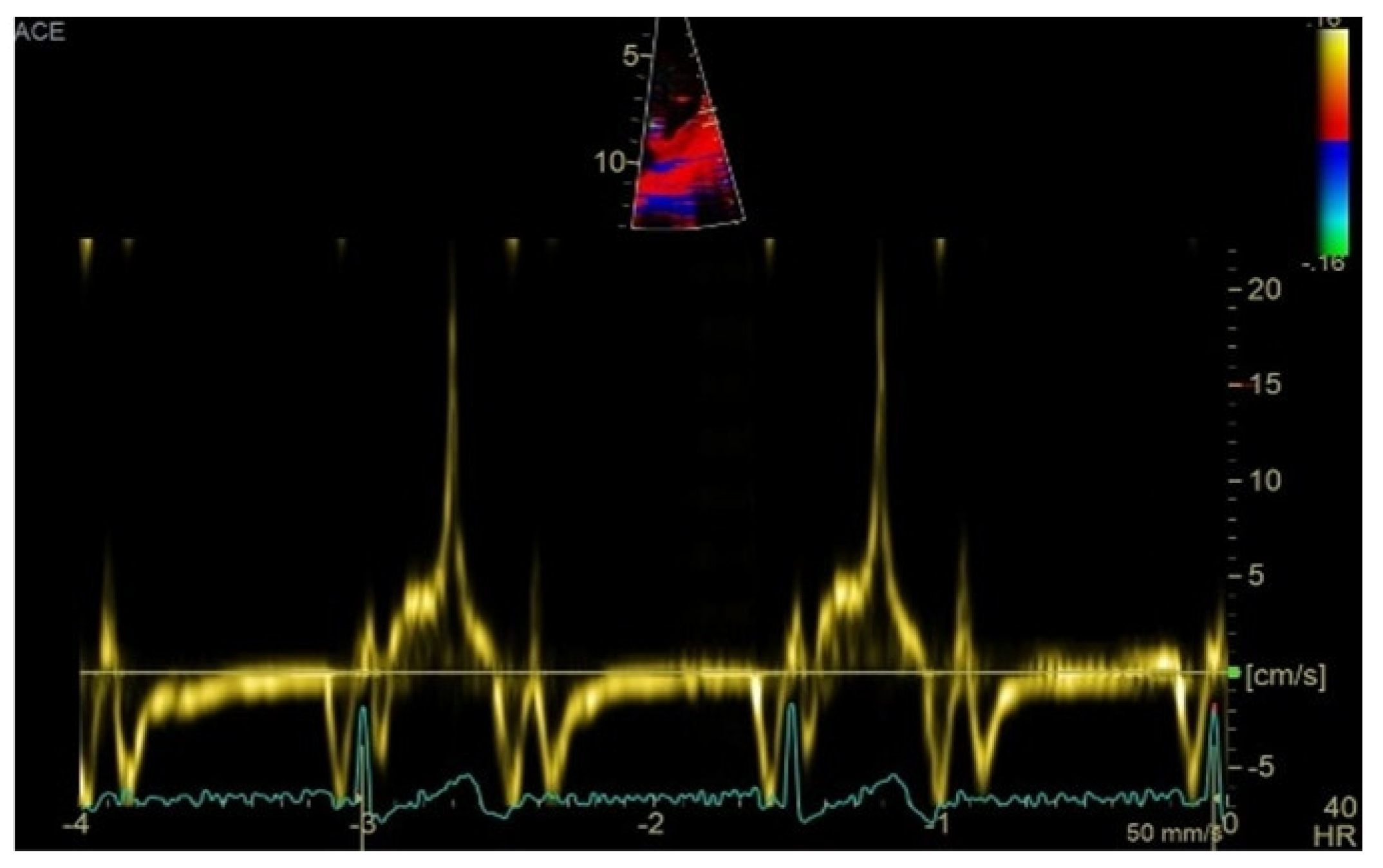 Medsci 13 00185 g003