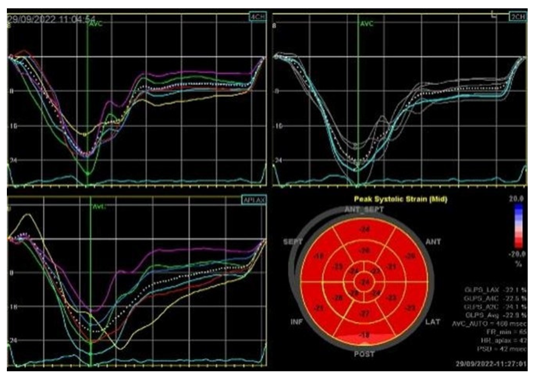 Medsci 13 00185 g005