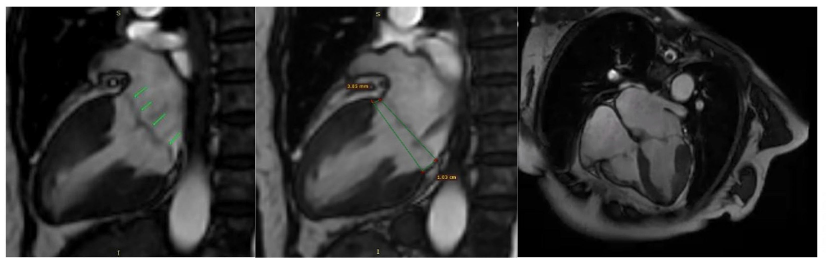 Medsci 13 00185 g008