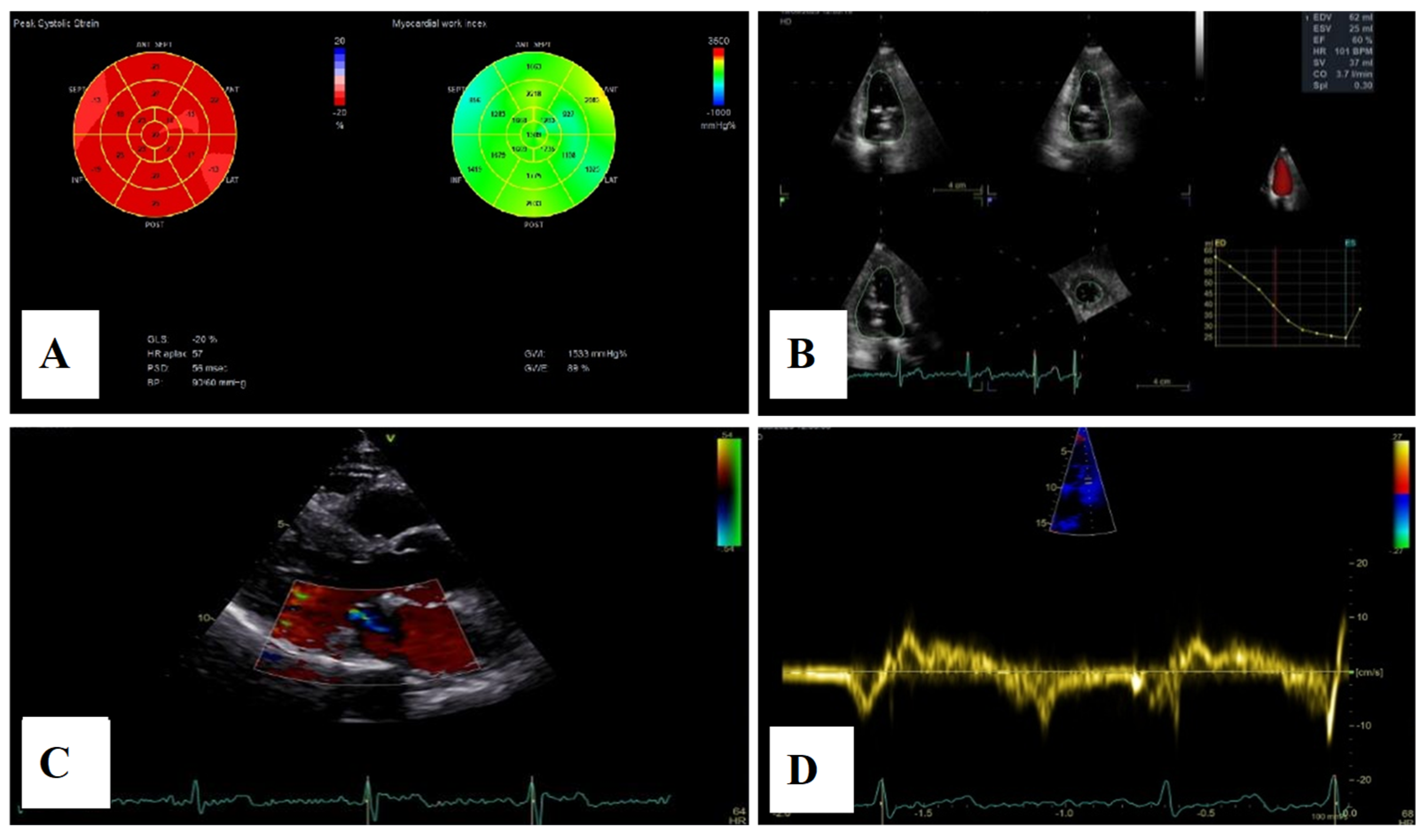 Medsci 13 00185 g011
