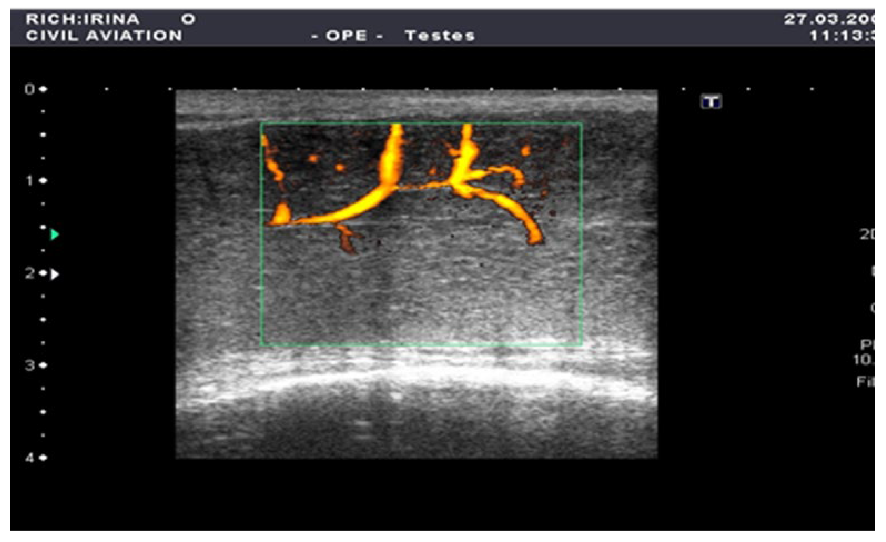 Medsci 13 00208 g002 Medsci 13 00208 g002