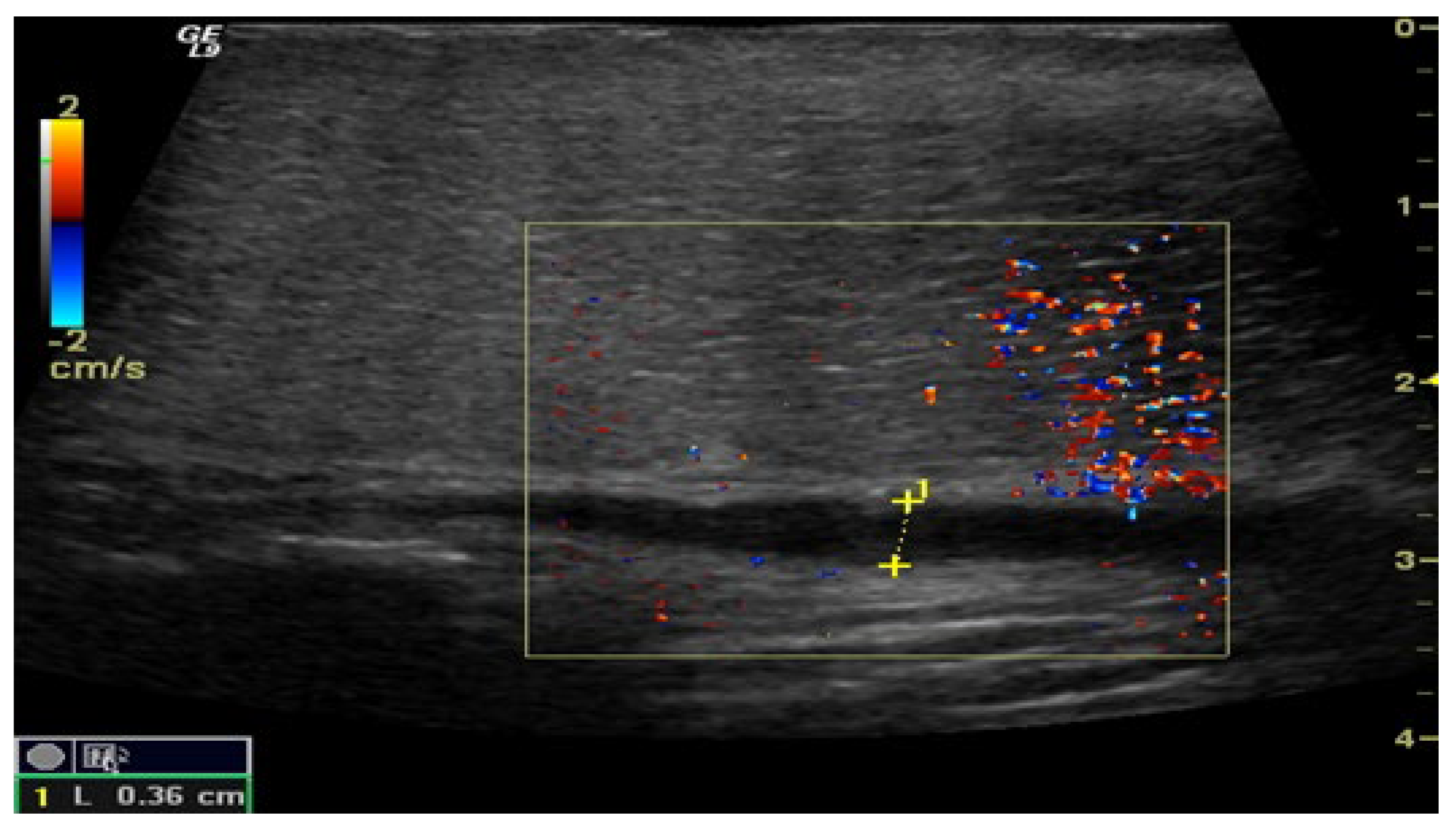 Medsci 13 00208 g003 Medsci 13 00208 g003