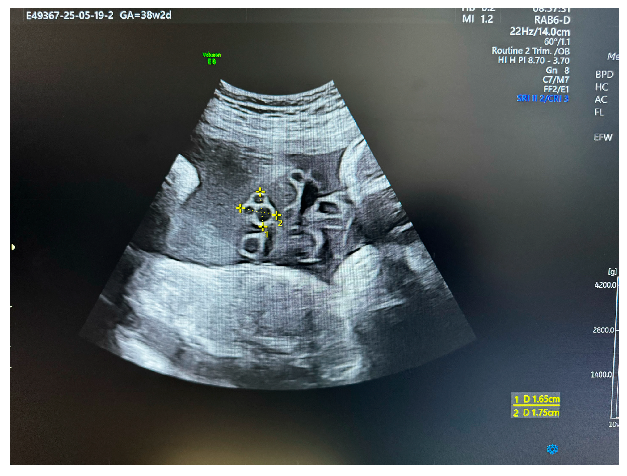 Medsci 13 00215 g002 Medsci 13 00215 g002