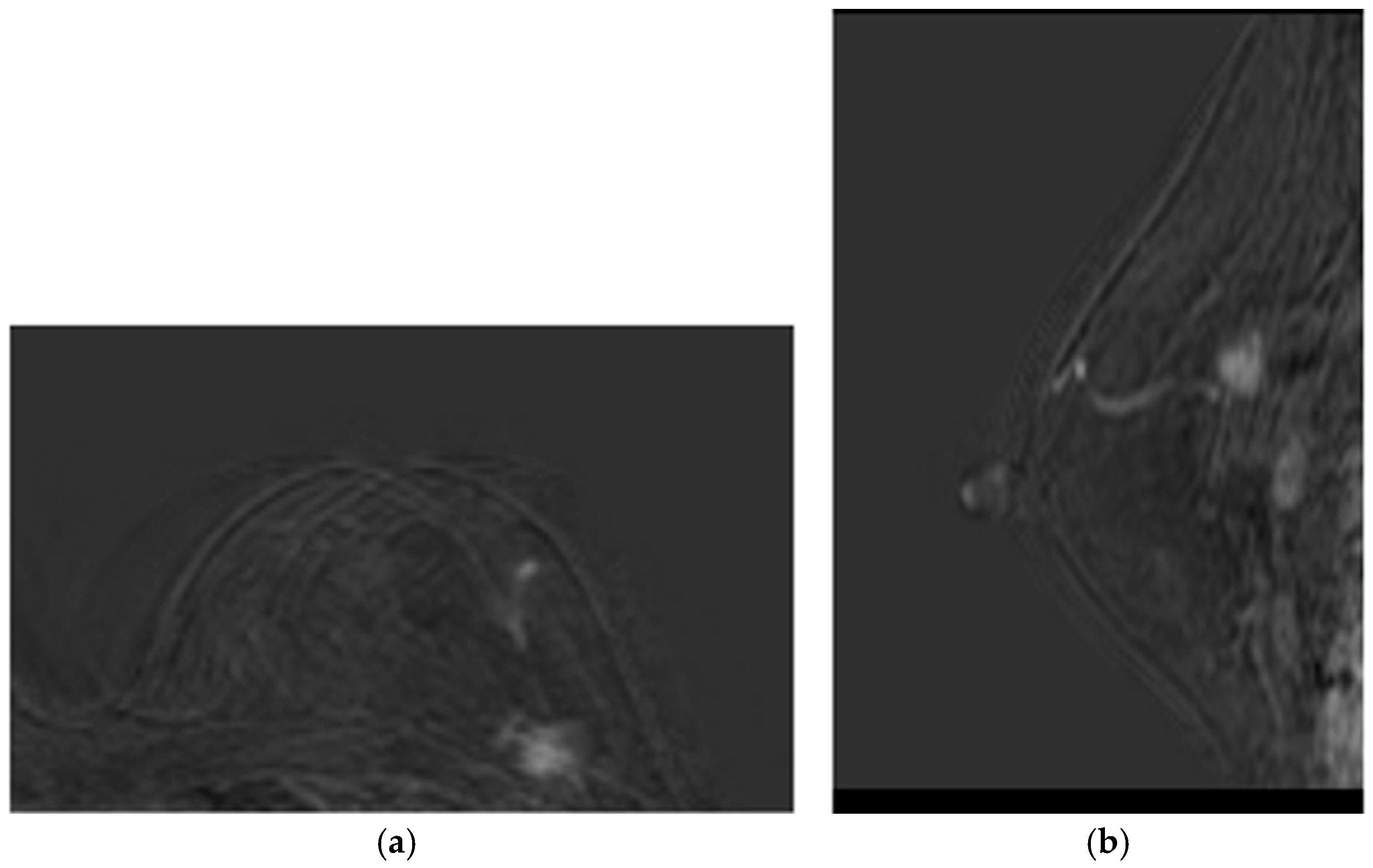 Medsci 13 00242 g003 Medsci 13 00242 g003
