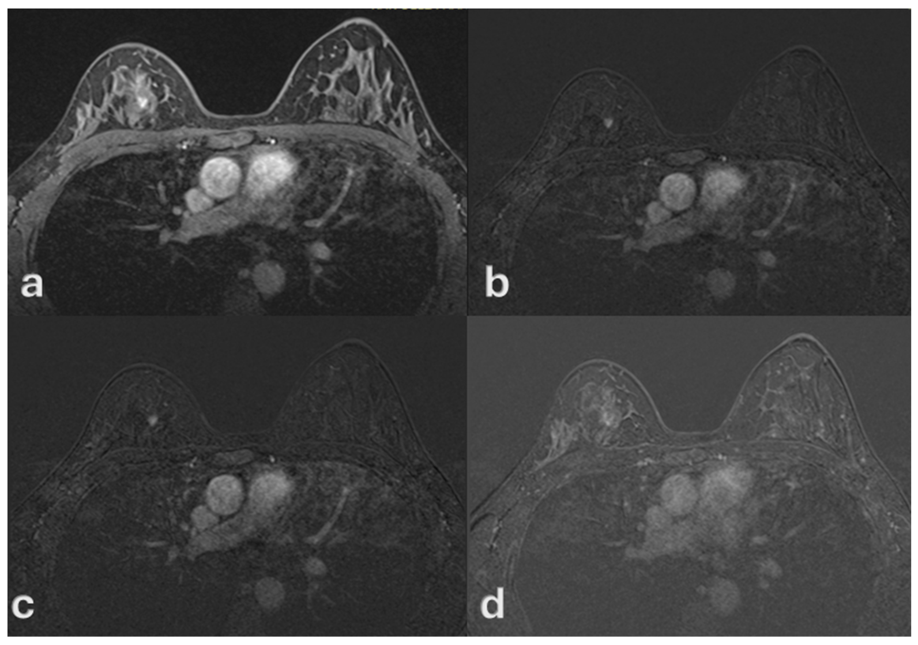 Medsci 13 00245 g004
