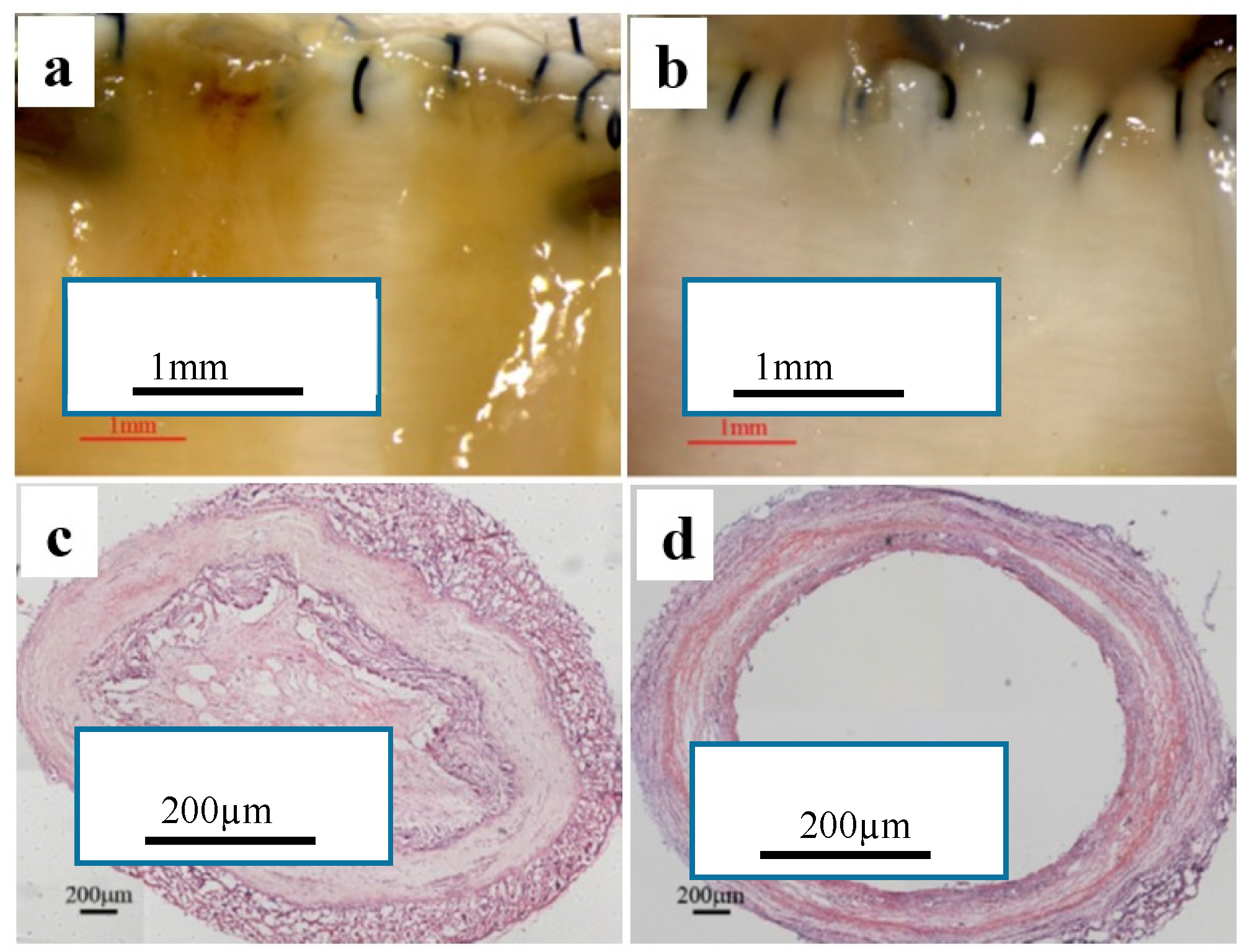 Membranes 08 00015 g011