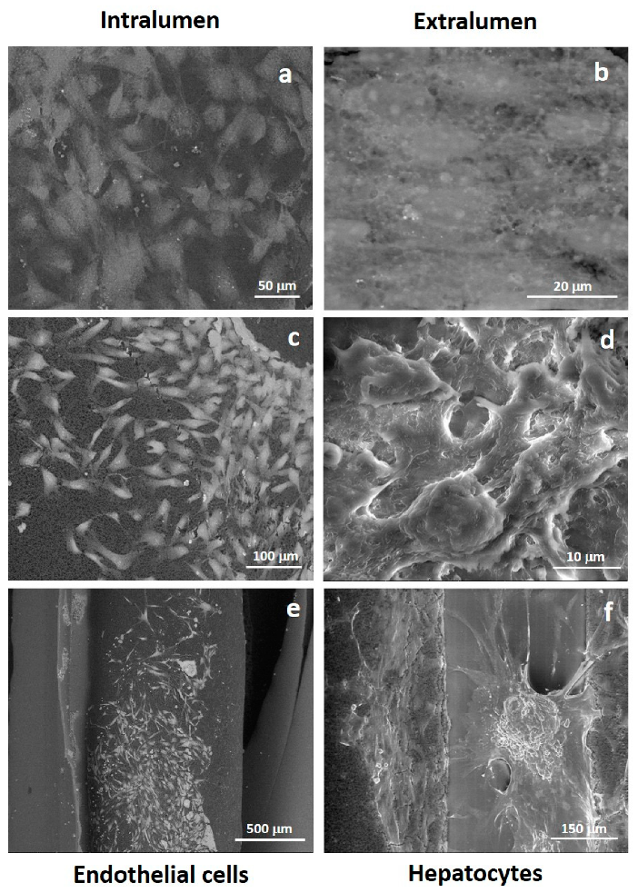 Membranes 10 00112 g005