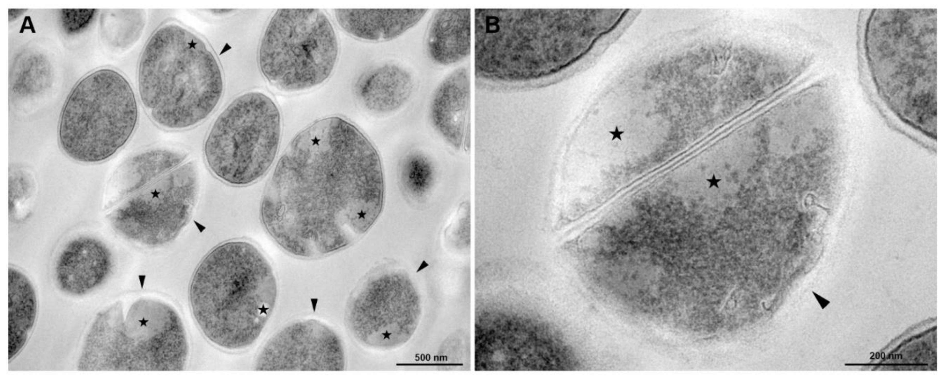 Membranes 10 00130 g008a Membranes 10 00130 g008a