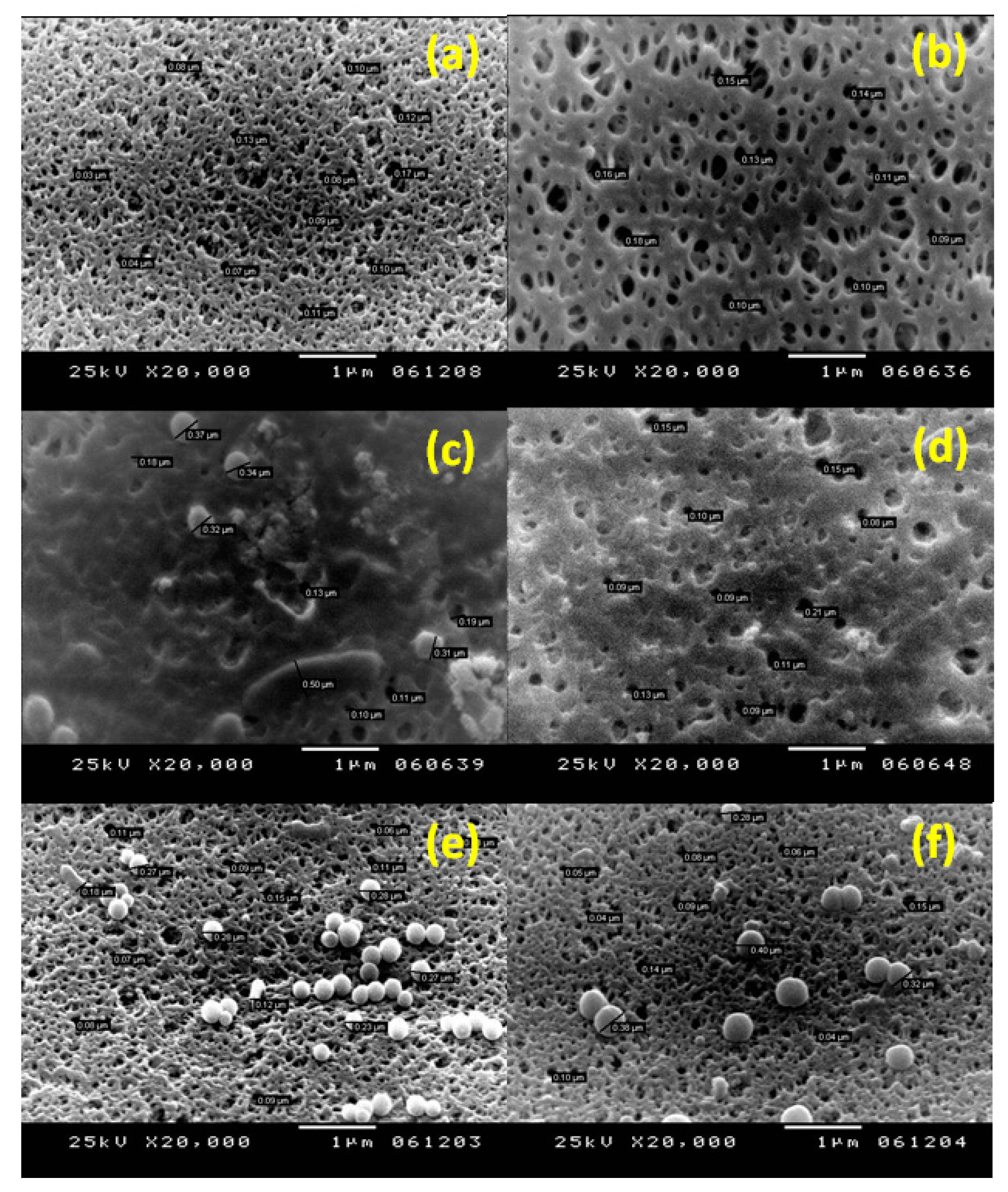 Membranes 10 00227 g012