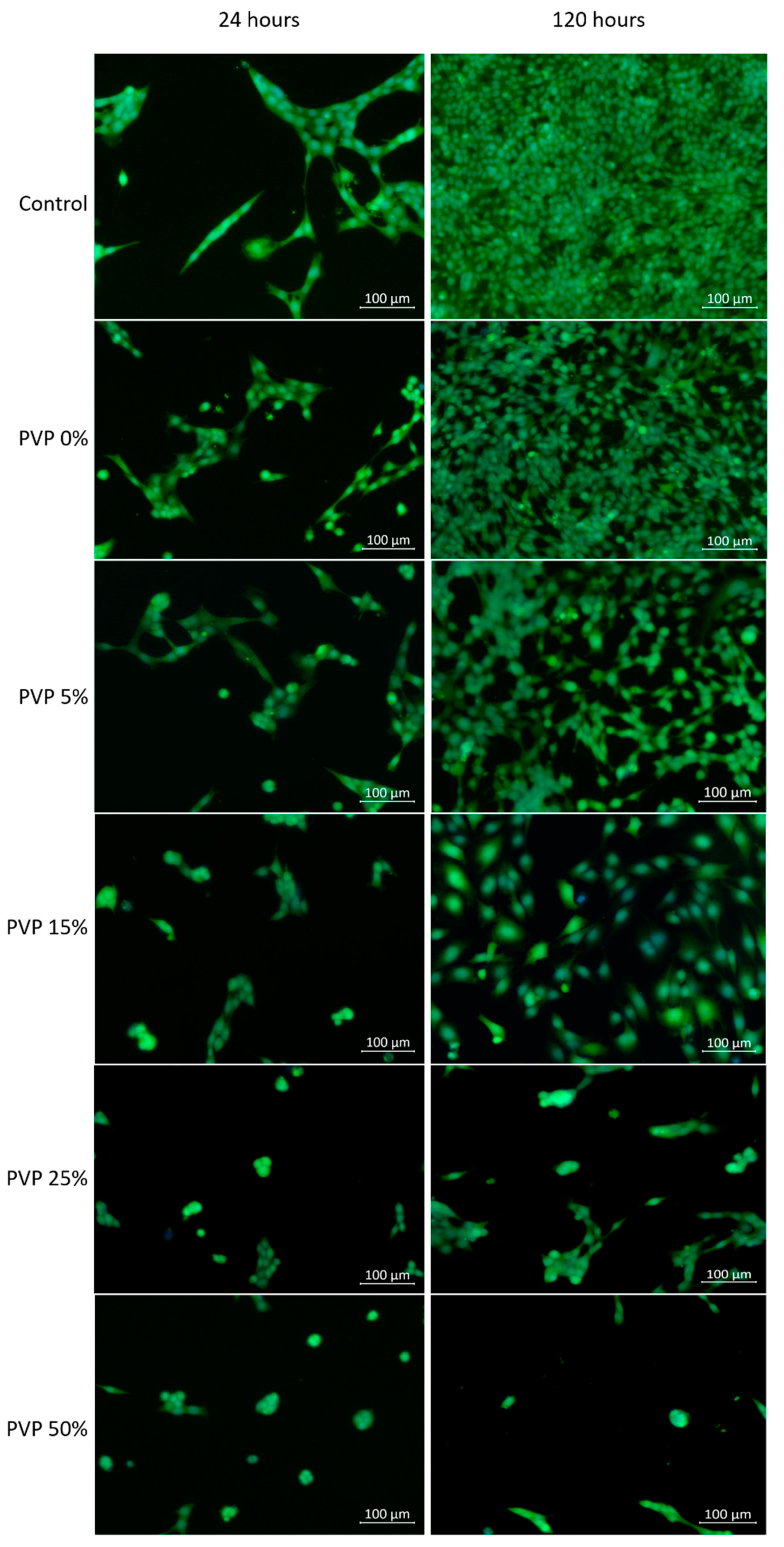 Membranes 11 00021 g005