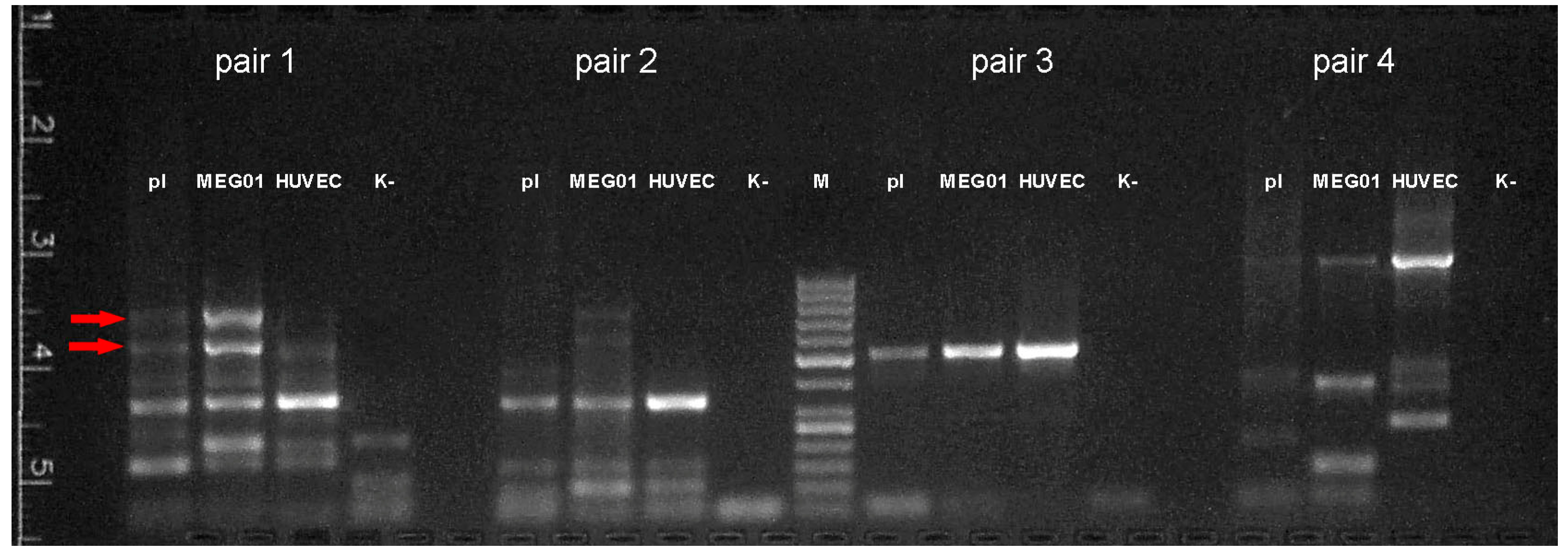 Membranes 11 00218 g006