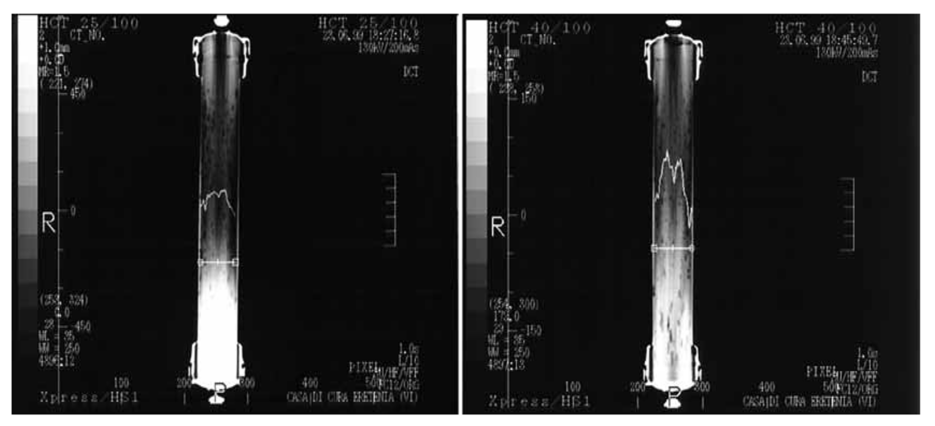 Membranes 11 00767 g011 Membranes 11 00767 g011