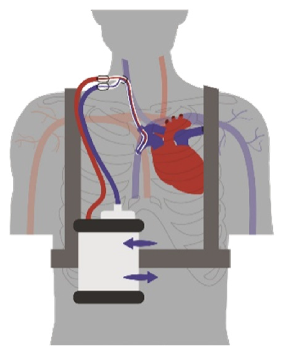 Membranes 12 00133 g001