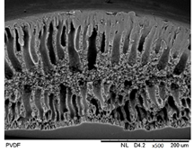 Membranes 12 00208 i001