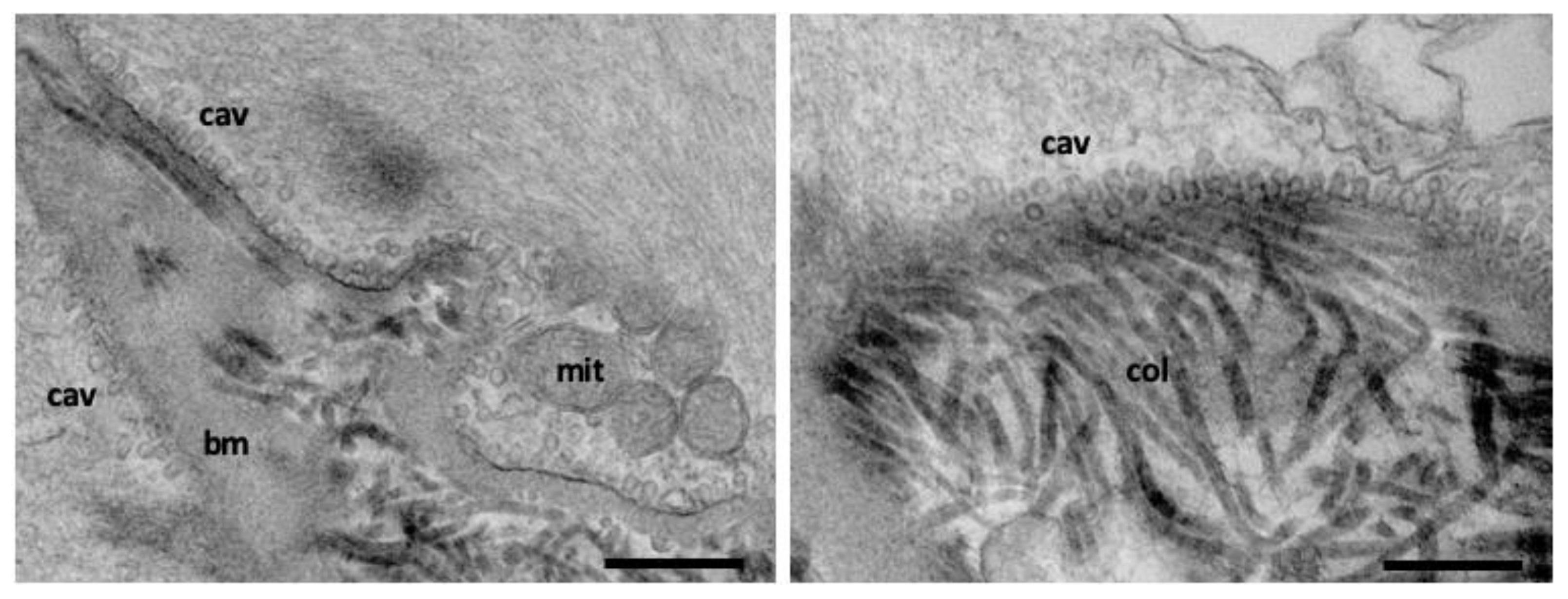 Membranes 12 00393 g003 Membranes 12 00393 g003