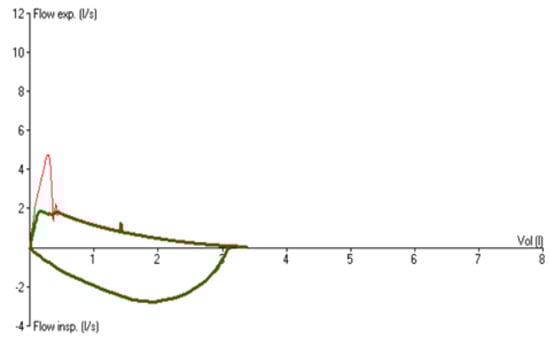 Membranes 12 00548 g0a1 550