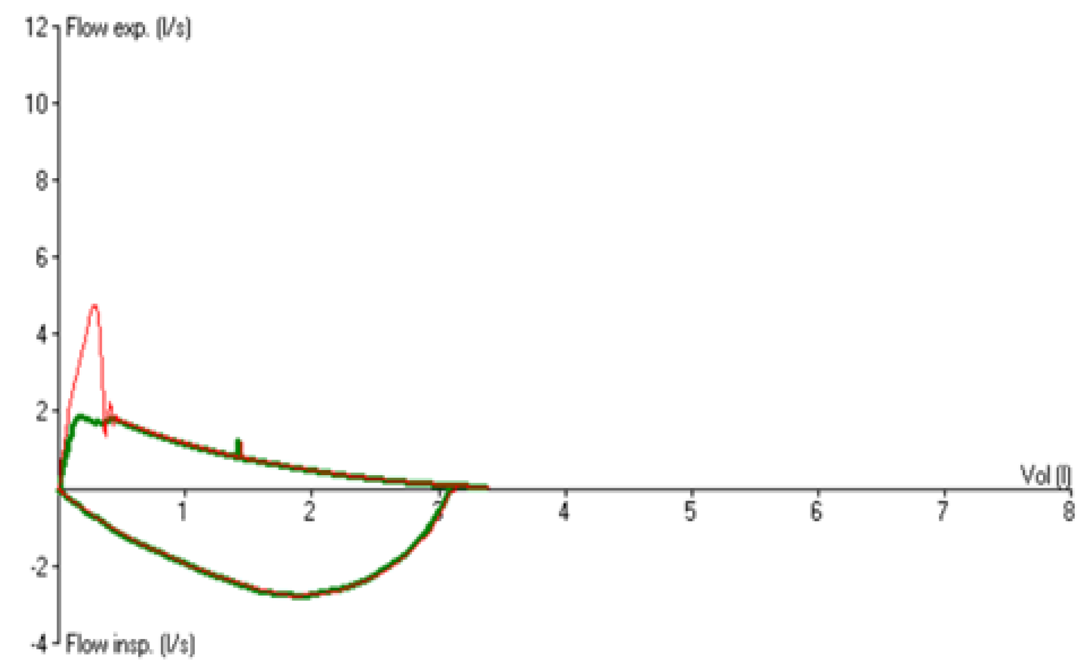 Membranes 12 00548 g0a1 Membranes 12 00548 g0a1