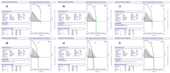 Membranes 12 00548 g0a2 550