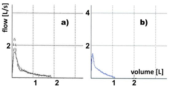Membranes 12 00548 g0a3 550