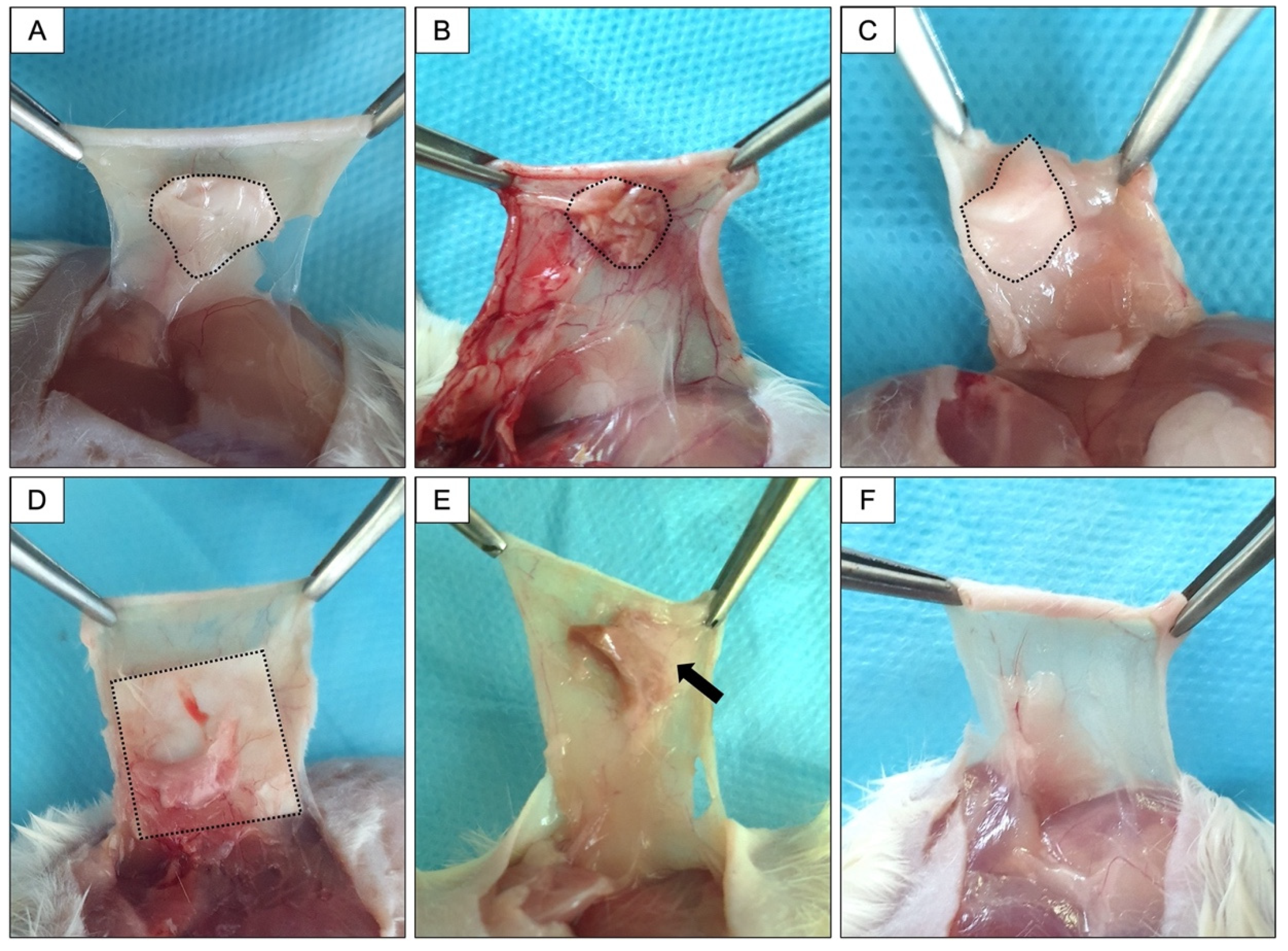 Membranes 12 00711 g005