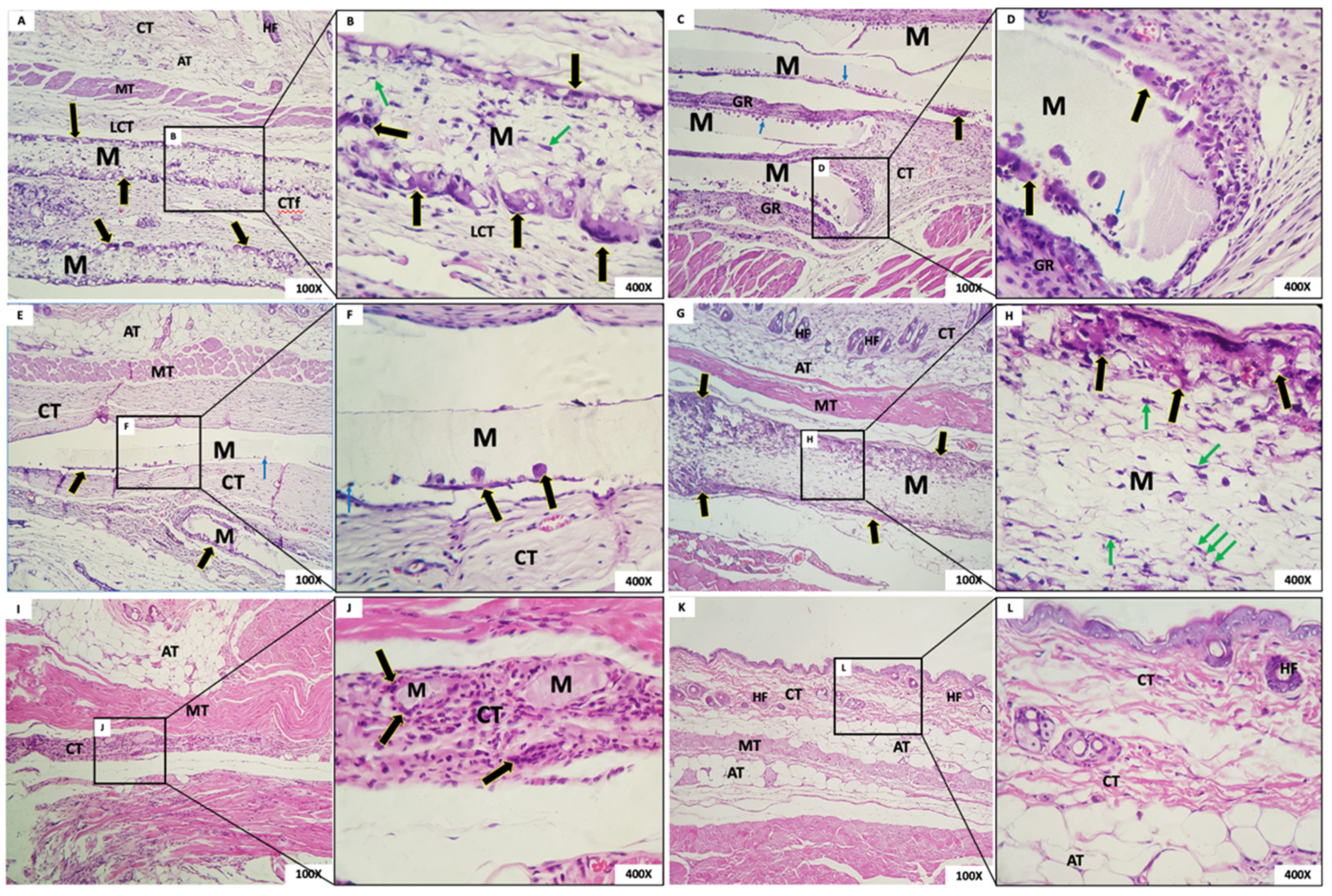 Membranes 12 00711 g009