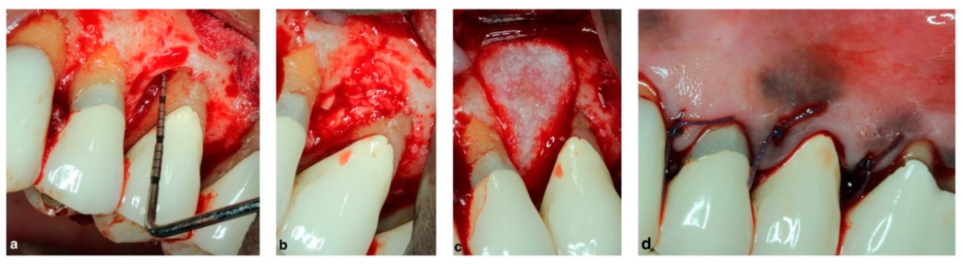 Membranes 12 00841 g001