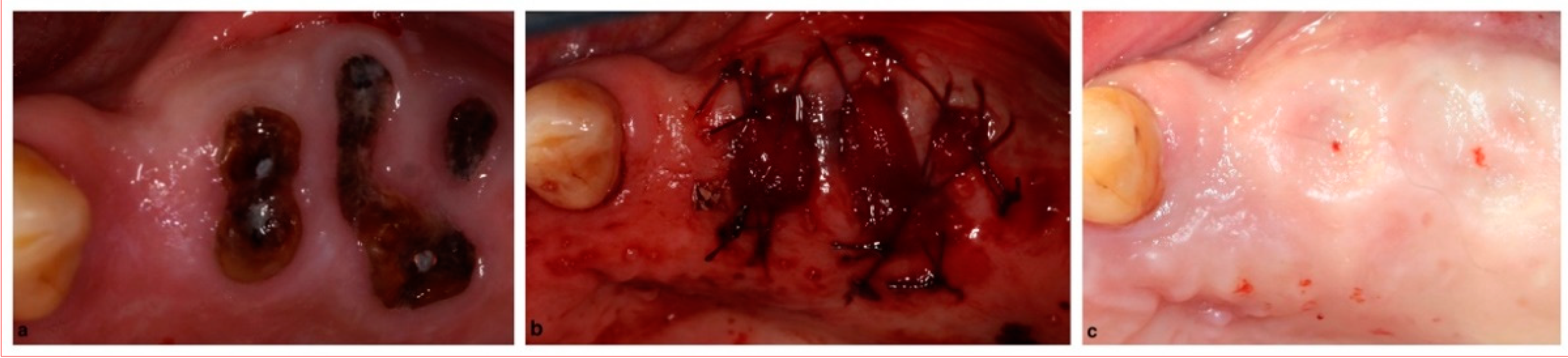 Membranes 12 00841 g002