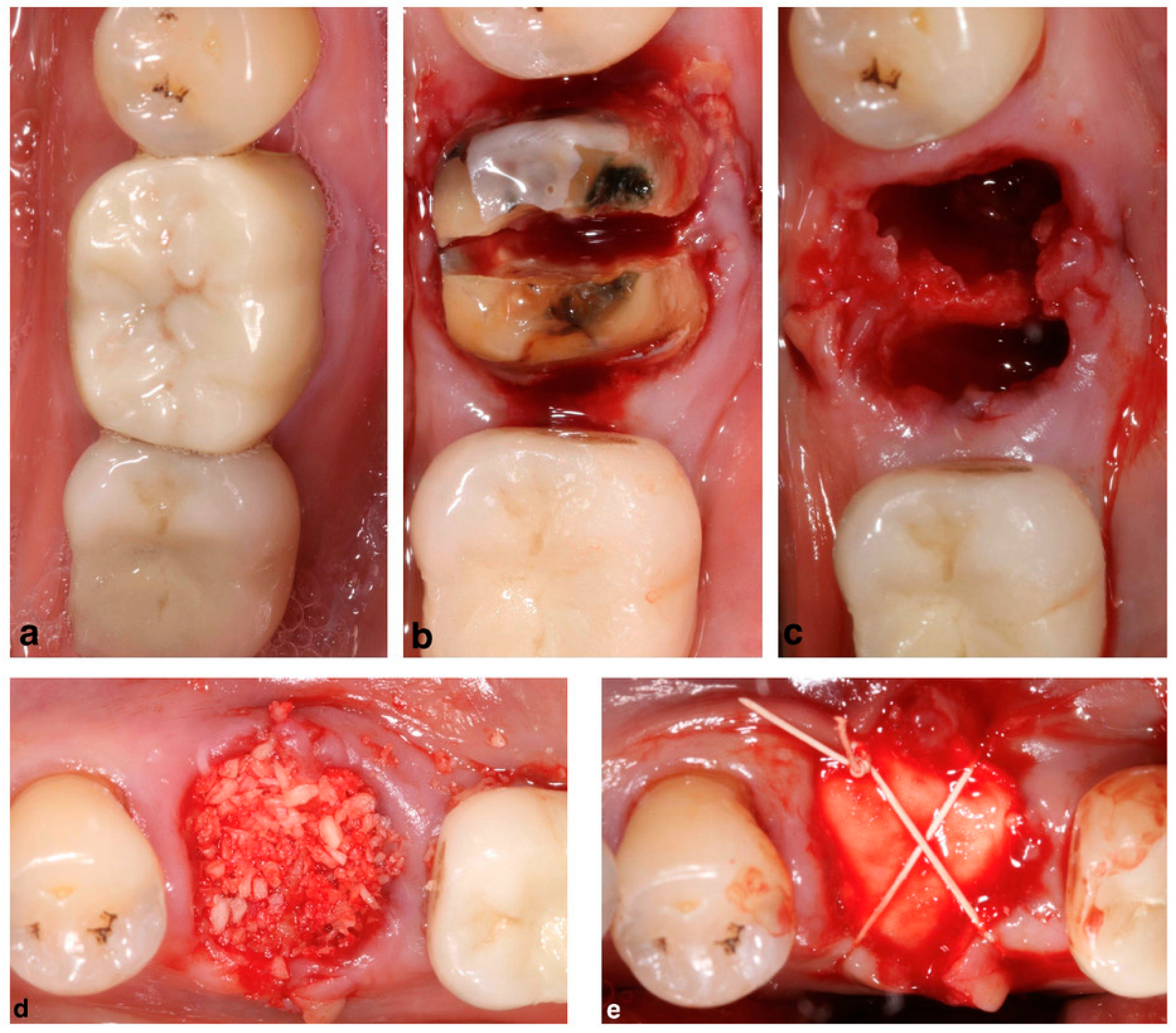 Membranes 12 00841 g003