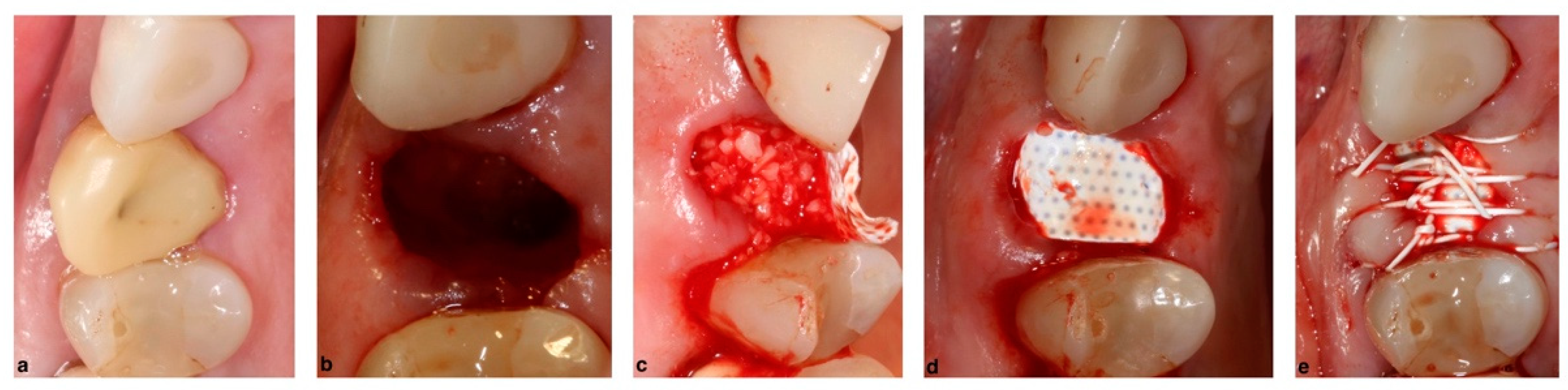 Membranes 12 00841 g004