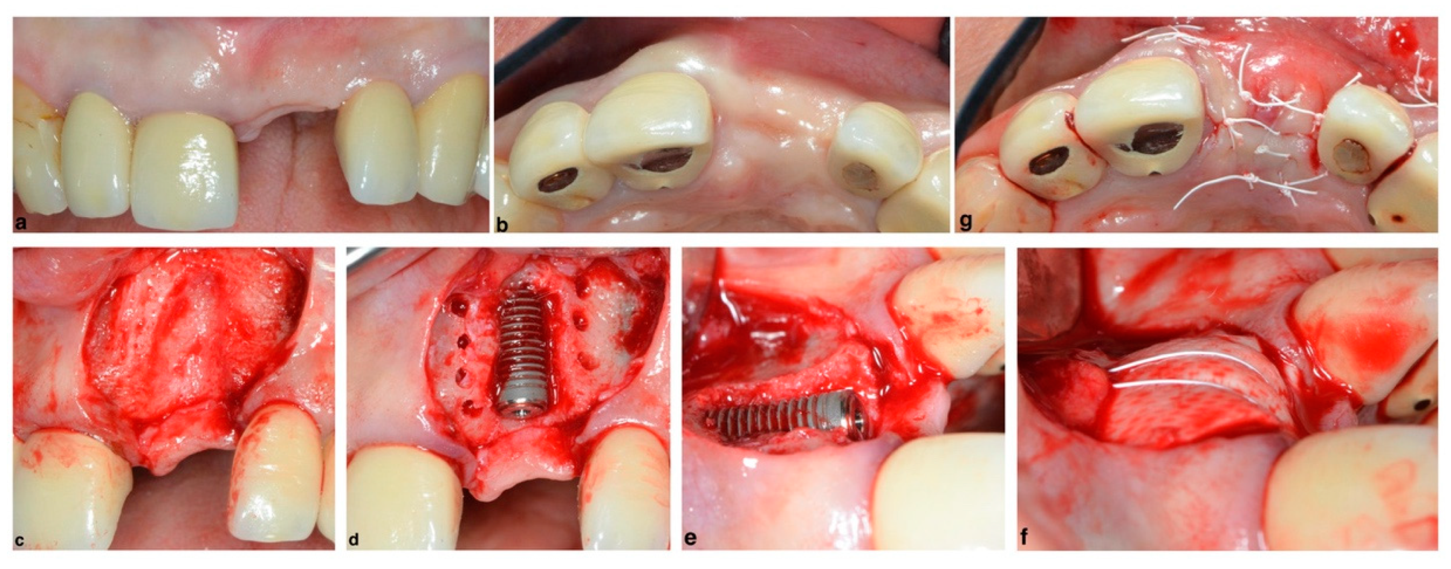Membranes 12 00841 g006