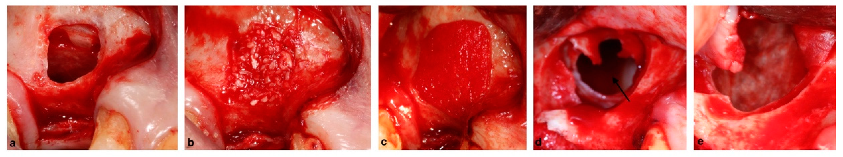 Membranes 12 00841 g008