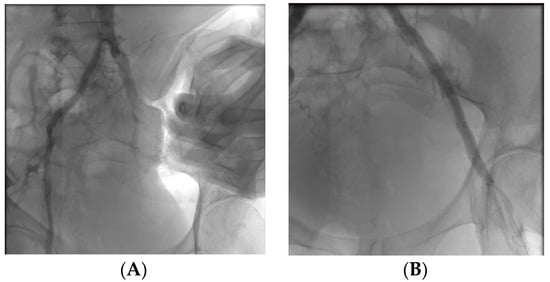 Membranes 13 00240 g0a3