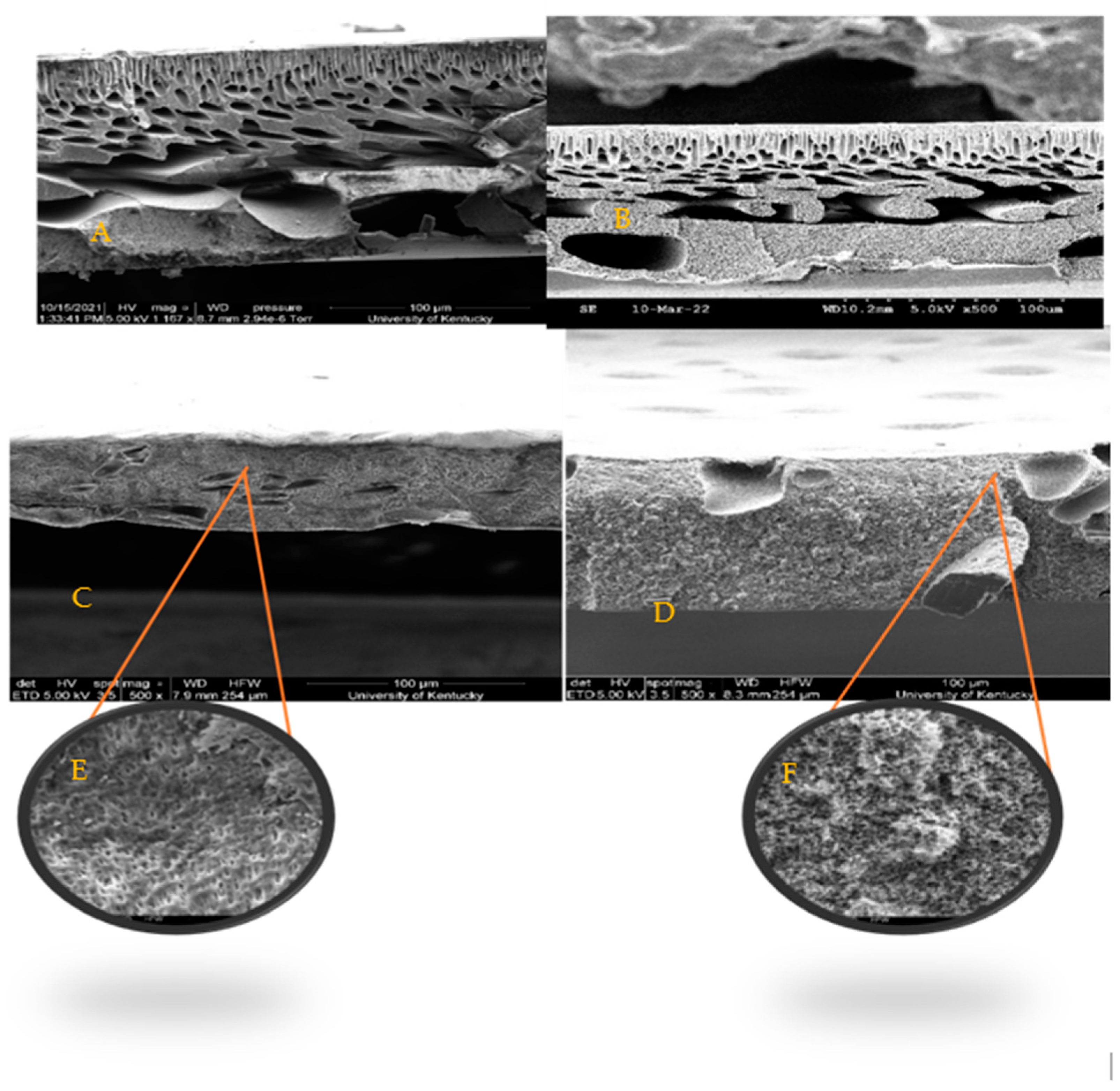 Membranes 14 00153 g004