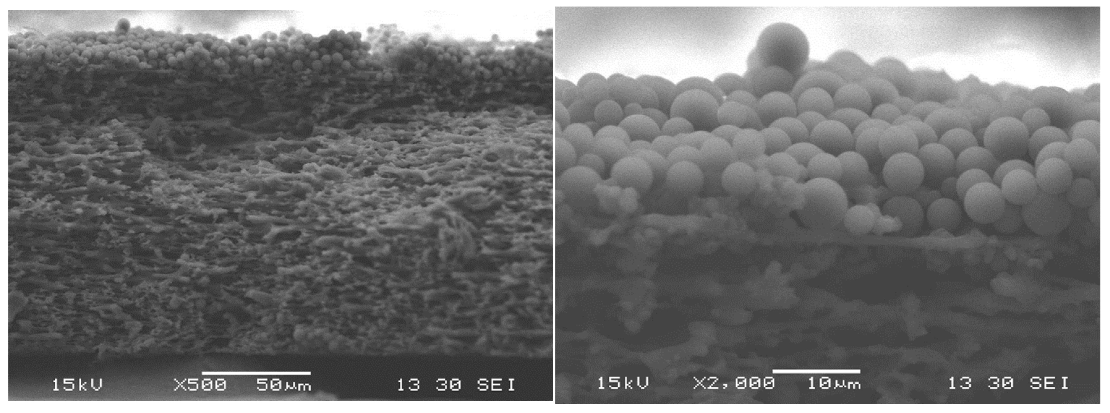 Membranes 15 00272 g014b