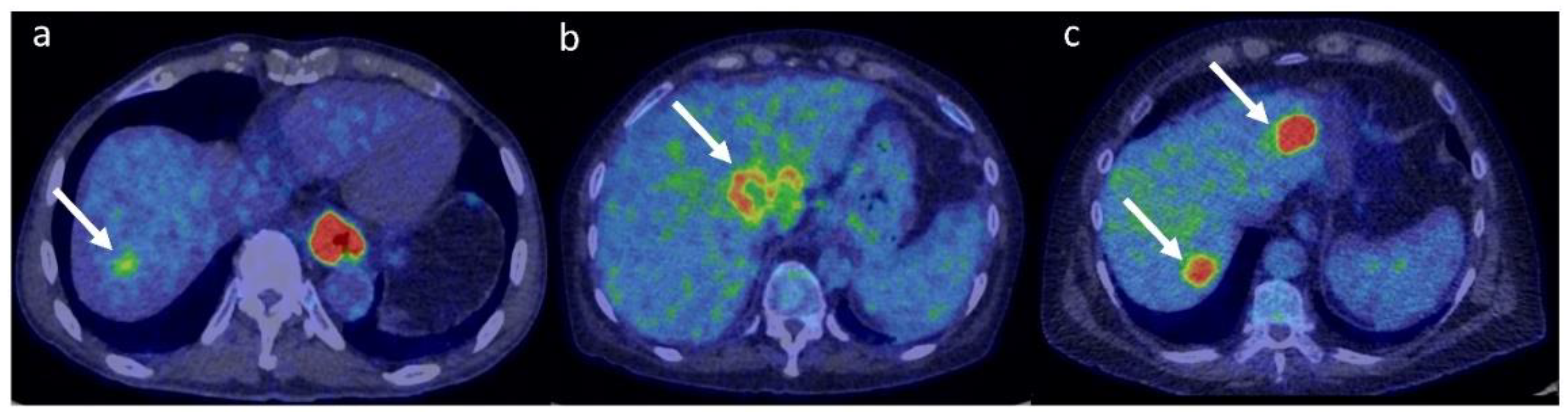 Metabolites 12 00321 g005