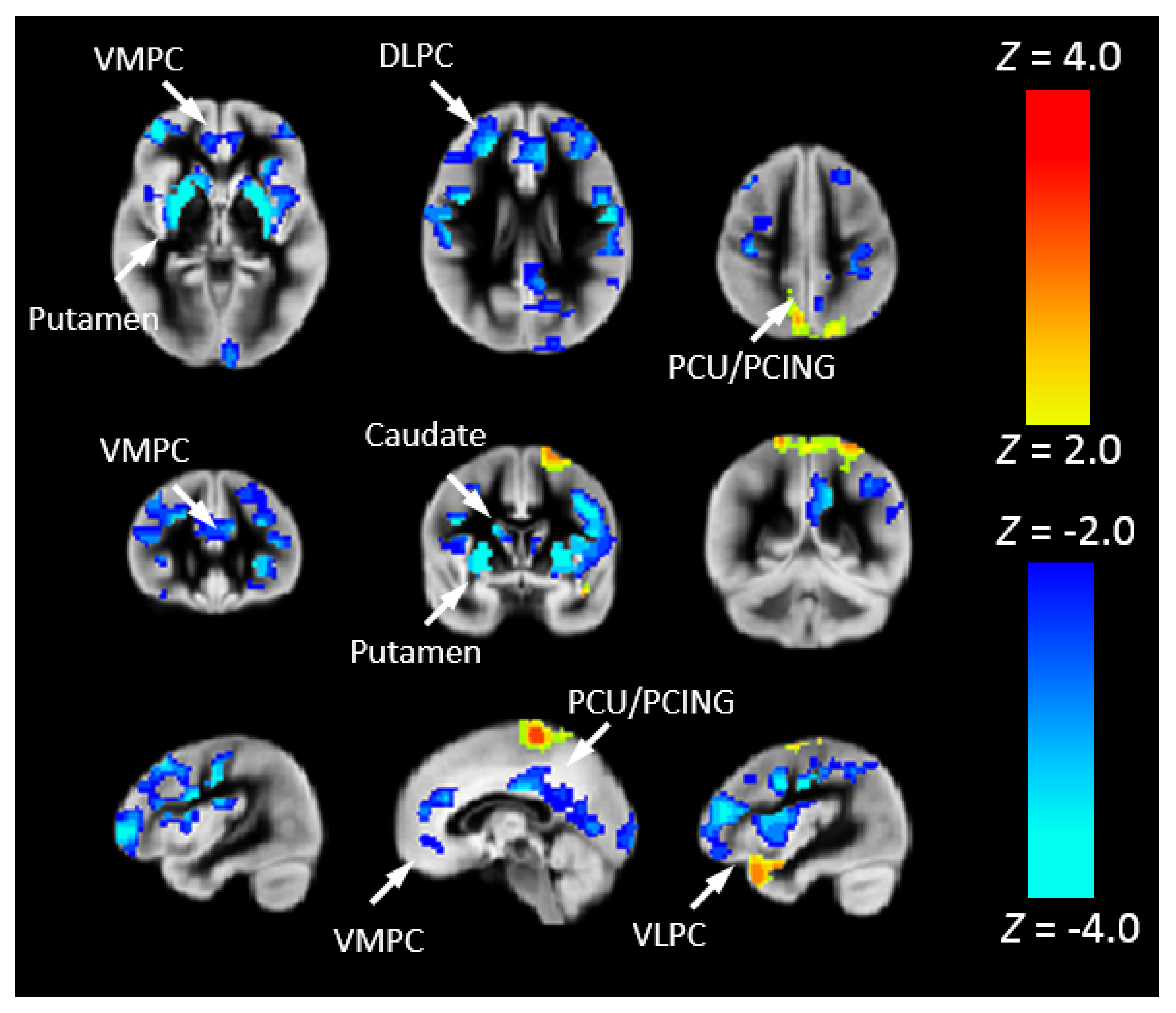 Metabolites 12 00882 g007