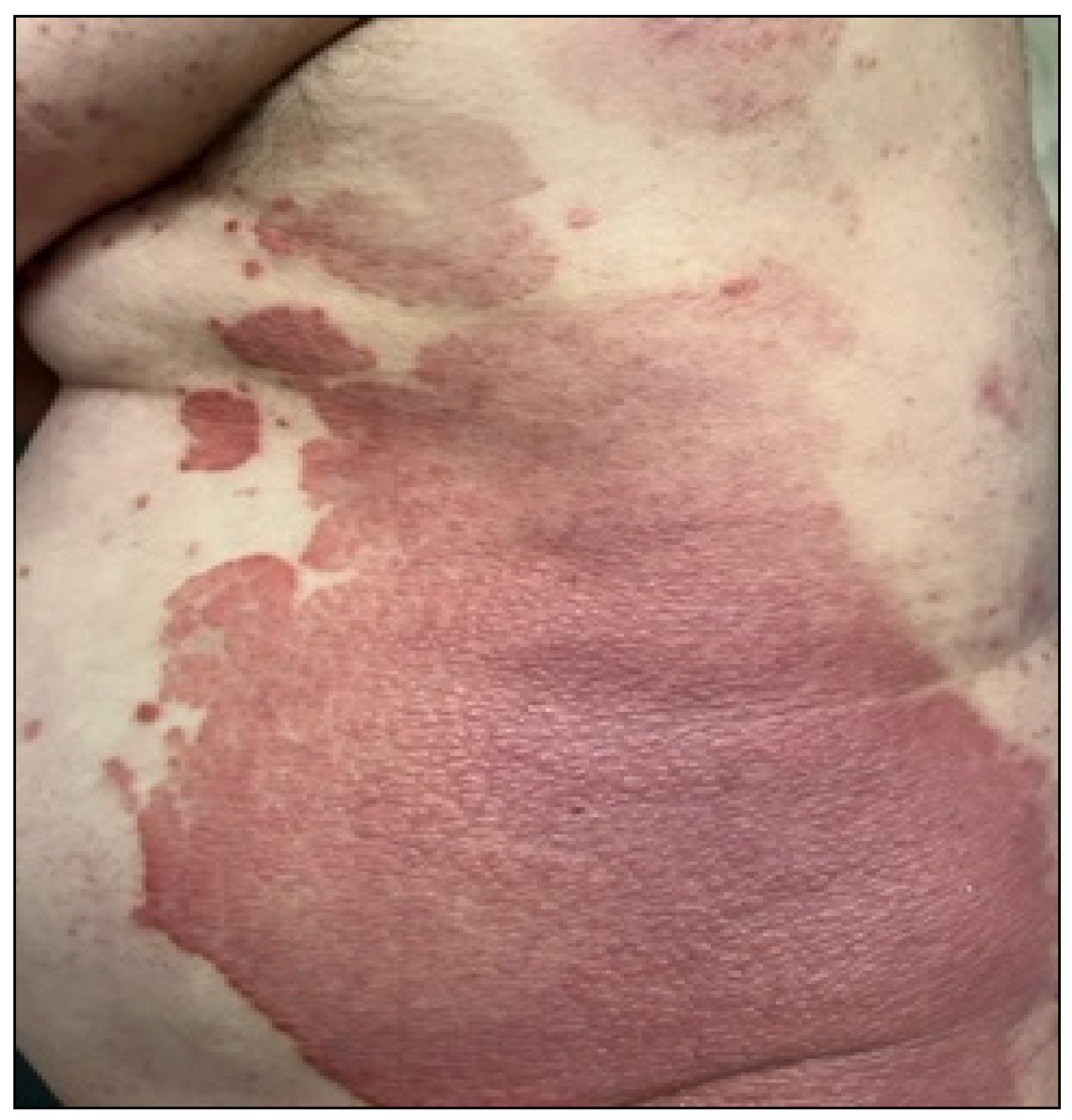 Metabolites 12 01171 g001