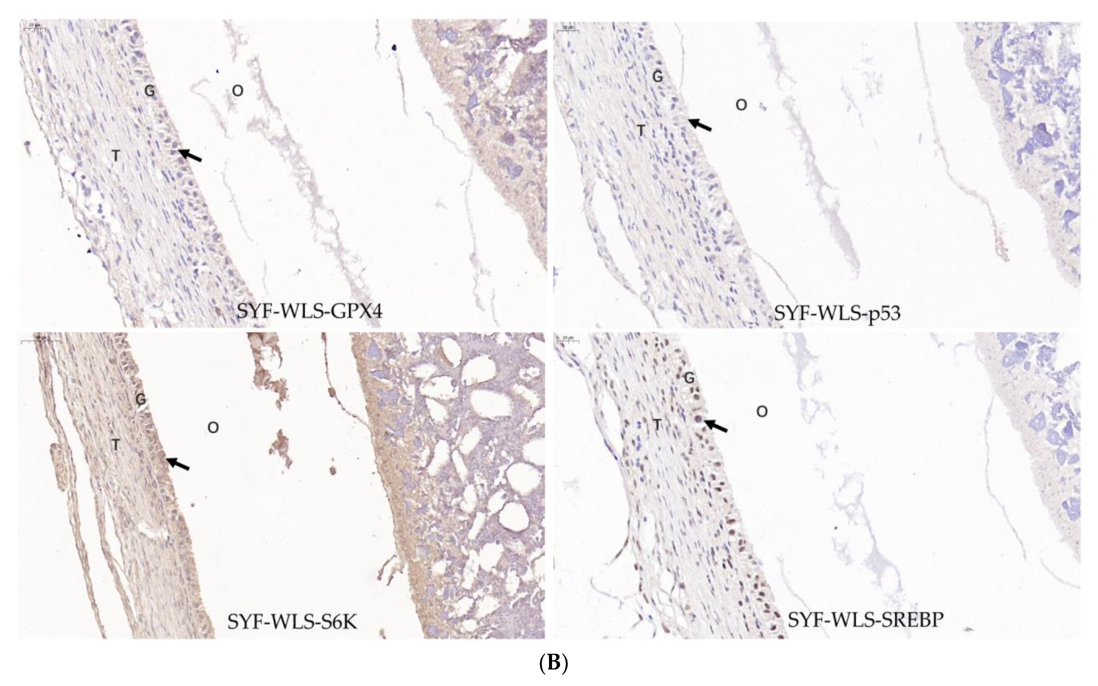 Metabolites 13 00176 g007b