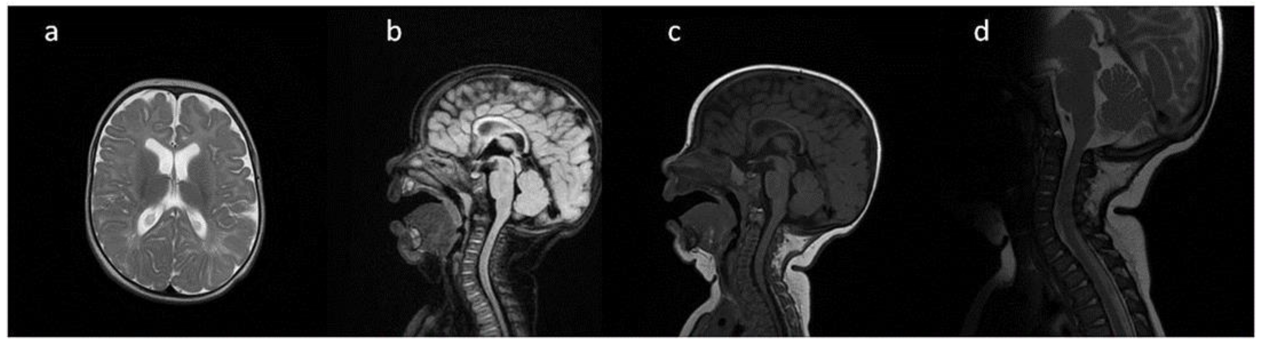 Metabolites 13 00209 g001