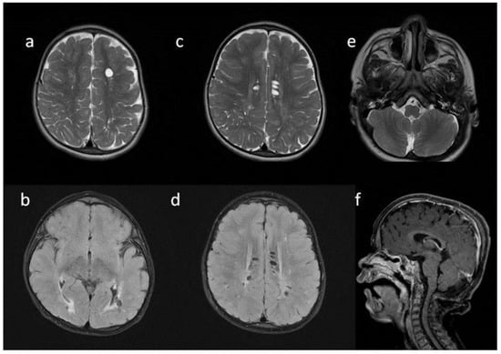 Metabolites 13 00209 g002