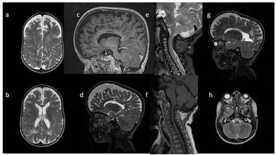 Metabolites 13 00209 g004