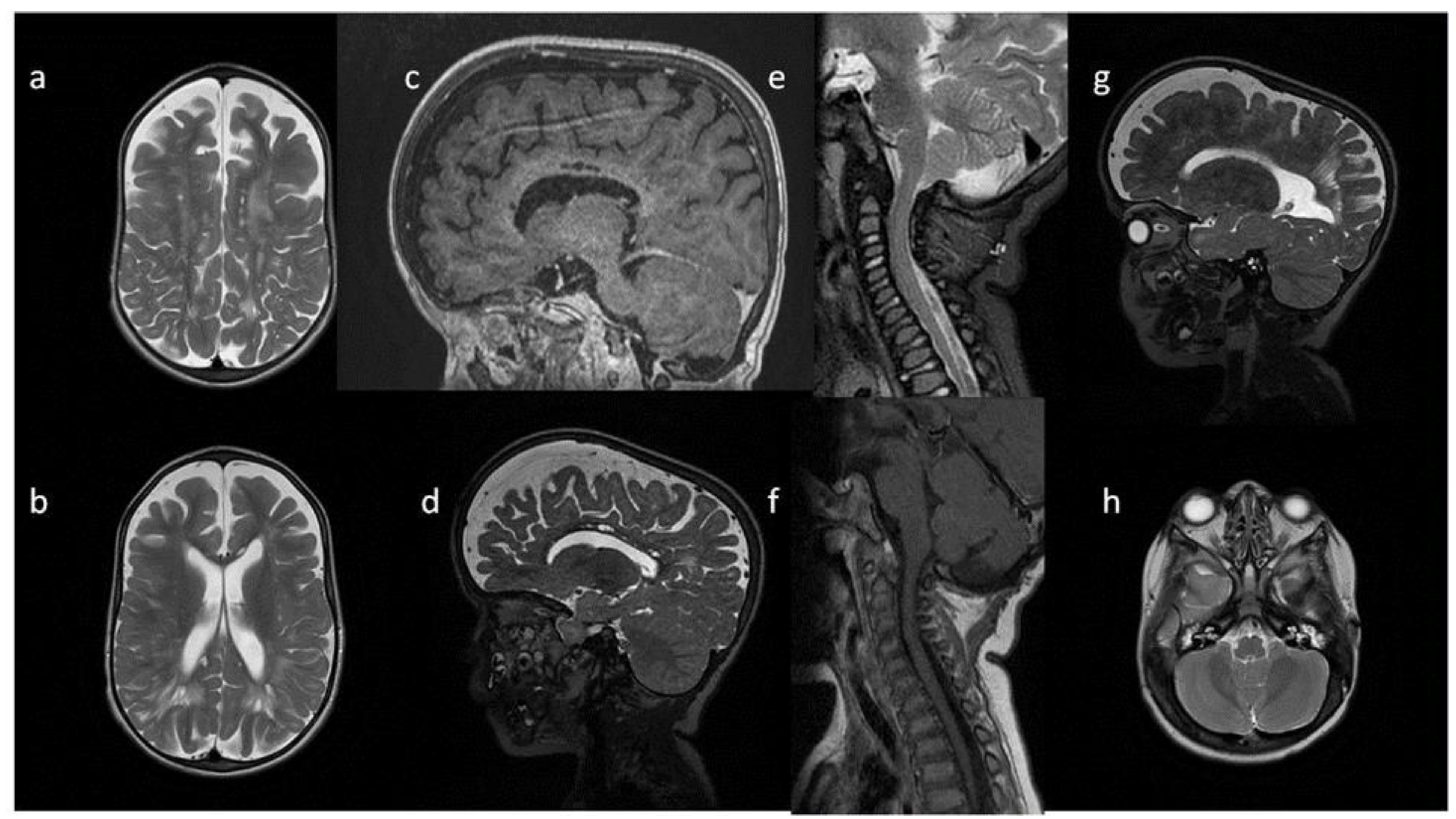 Metabolites 13 00209 g004
