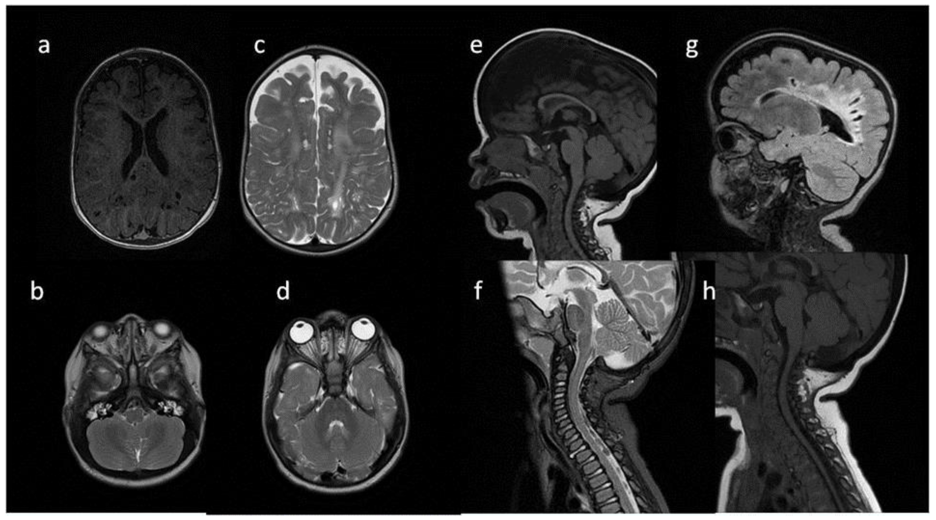 Metabolites 13 00209 g005
