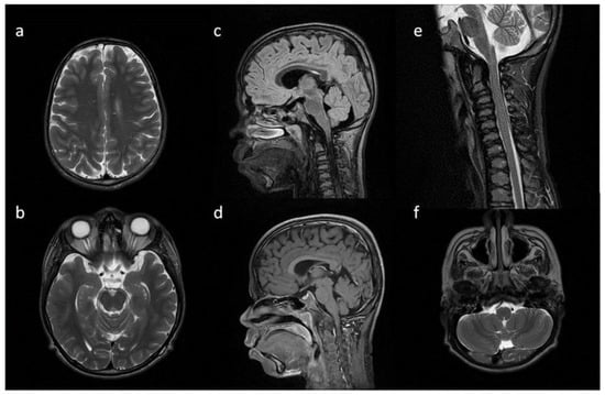 Metabolites 13 00209 g006