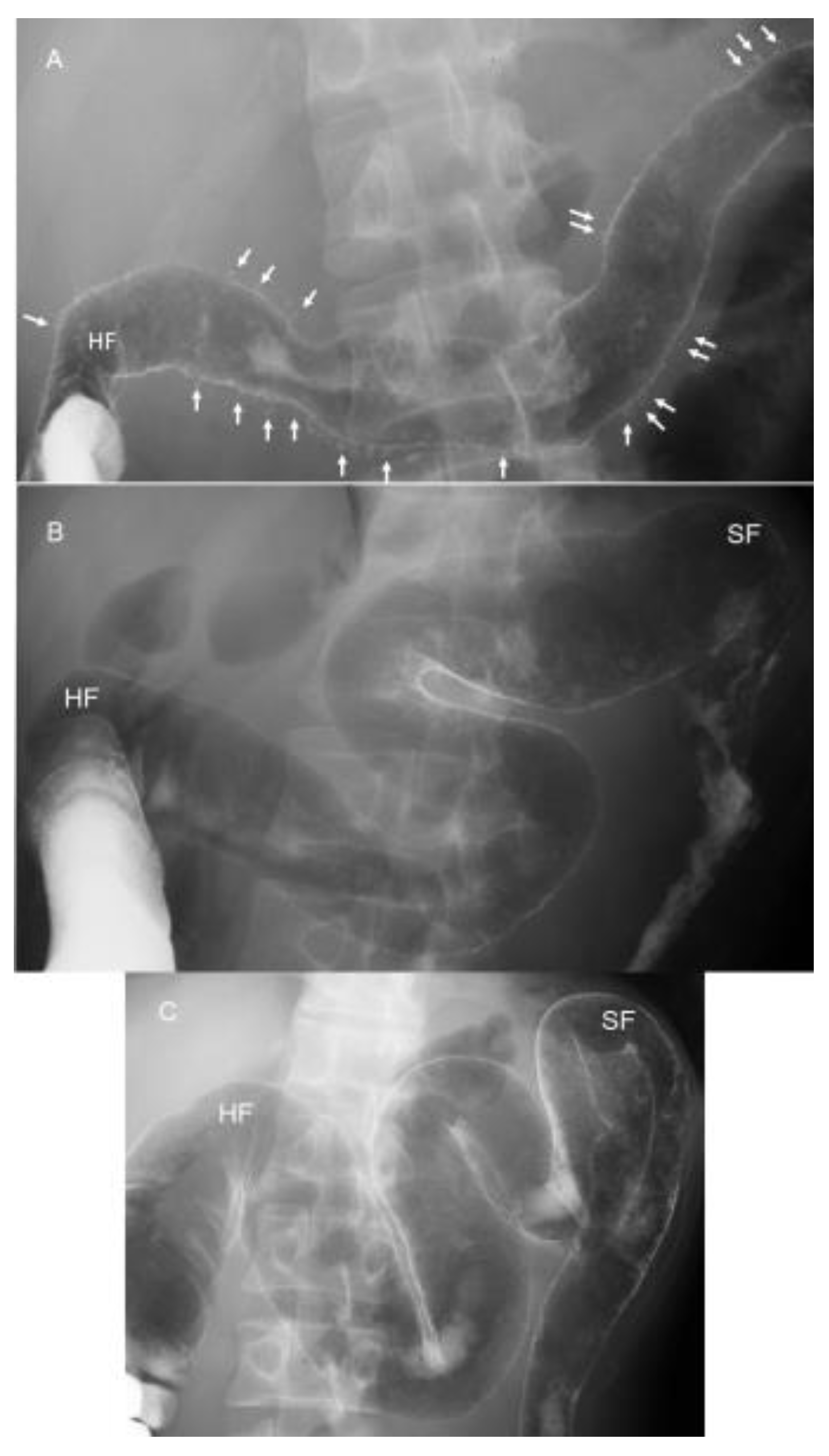 Metabolites 13 00332 g012