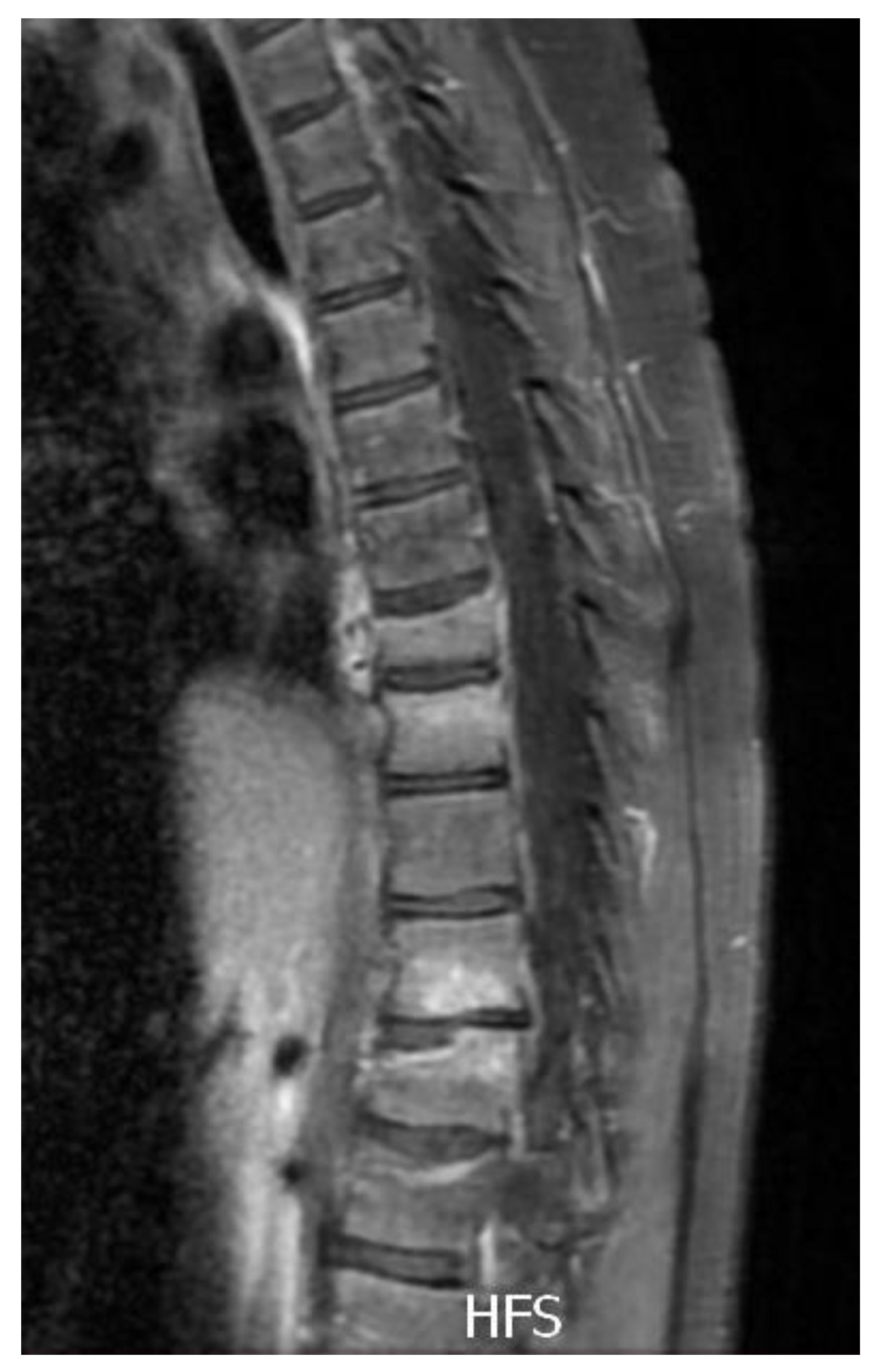Metabolites 13 00344 g002