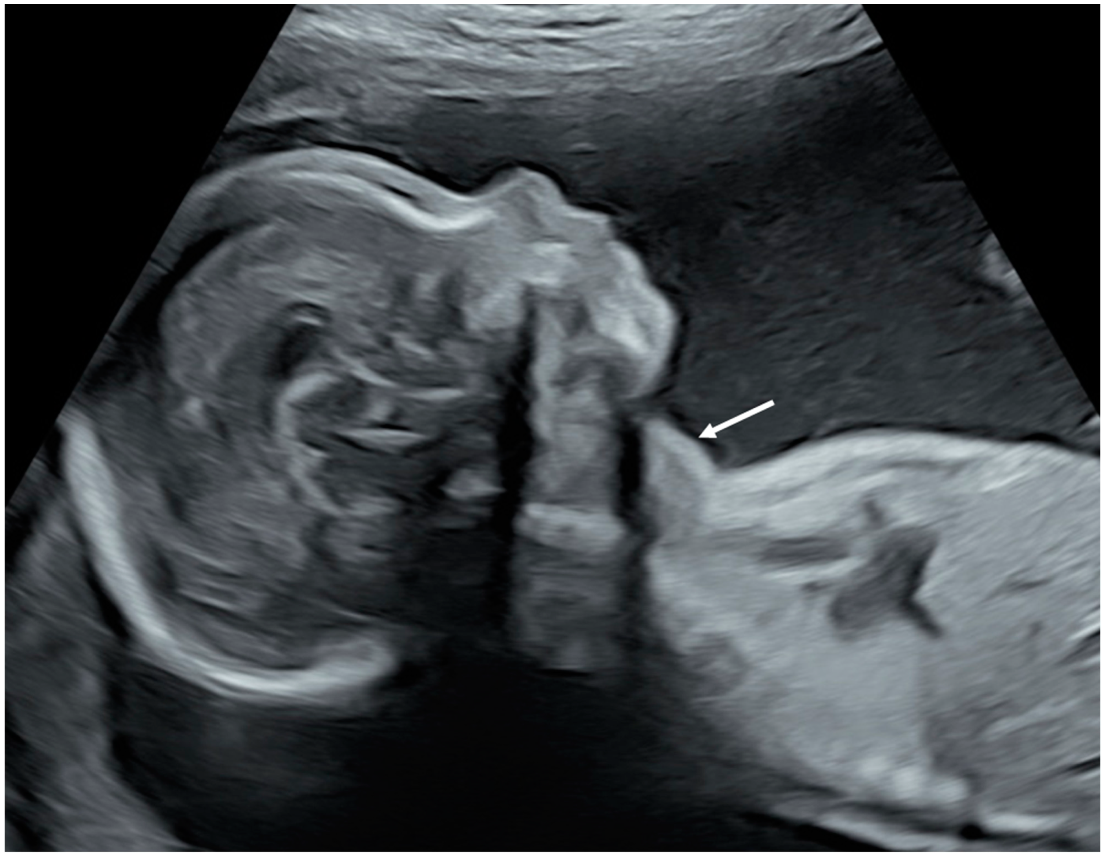 Metabolites 13 00633 g001